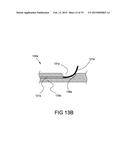 TISSUE EXPANSION DEVICES, SYSTEMS AND METHODS diagram and image