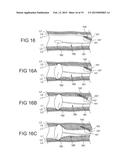 TISSUE EXPANSION DEVICES, SYSTEMS AND METHODS diagram and image