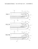 TISSUE EXPANSION DEVICES, SYSTEMS AND METHODS diagram and image