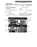 DEVICE AND METHOD FOR APPETITE SUPPRESSION AND WEIGHT LOSS MANAGEMENT diagram and image