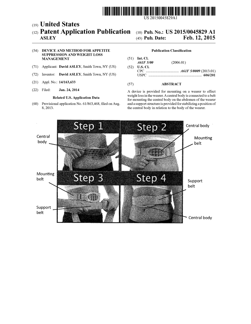 DEVICE AND METHOD FOR APPETITE SUPPRESSION AND WEIGHT LOSS MANAGEMENT - diagram, schematic, and image 01