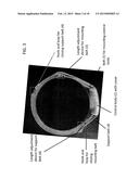 DEVICE AND METHOD FOR APPETITE SUPPRESSION AND WEIGHT LOSS MANAGEMENT diagram and image