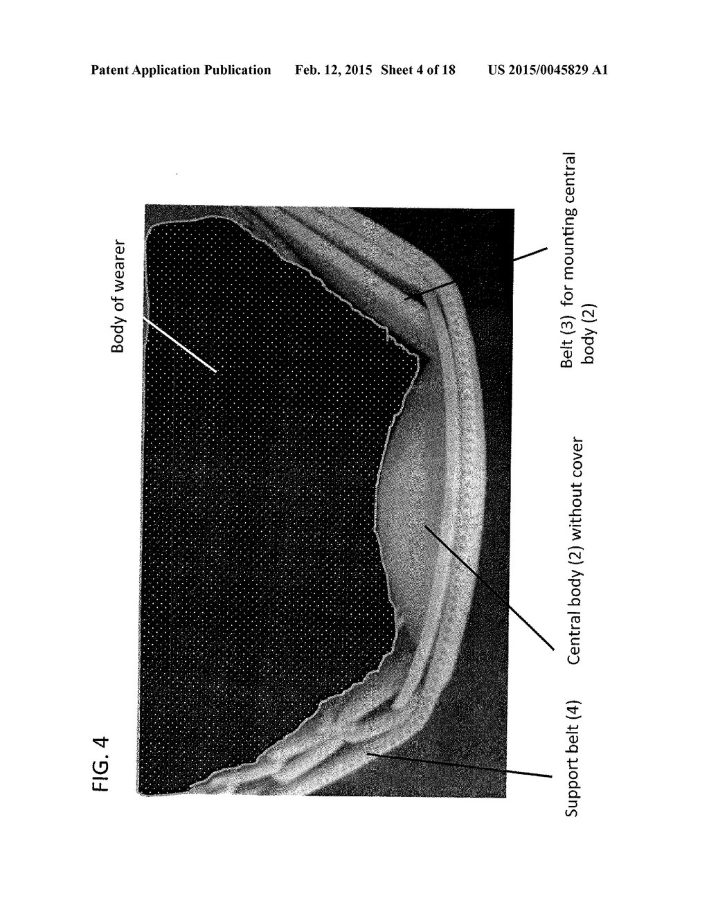 DEVICE AND METHOD FOR APPETITE SUPPRESSION AND WEIGHT LOSS MANAGEMENT - diagram, schematic, and image 05