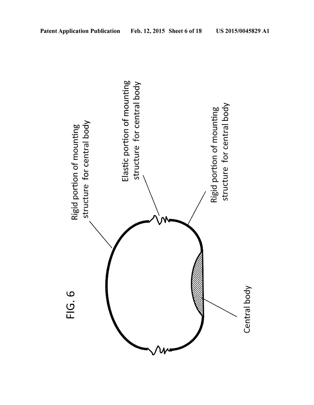 DEVICE AND METHOD FOR APPETITE SUPPRESSION AND WEIGHT LOSS MANAGEMENT - diagram, schematic, and image 07