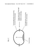 DEVICE AND METHOD FOR APPETITE SUPPRESSION AND WEIGHT LOSS MANAGEMENT diagram and image