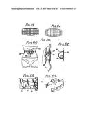 DEVICE AND METHOD FOR APPETITE SUPPRESSION AND WEIGHT LOSS MANAGEMENT diagram and image