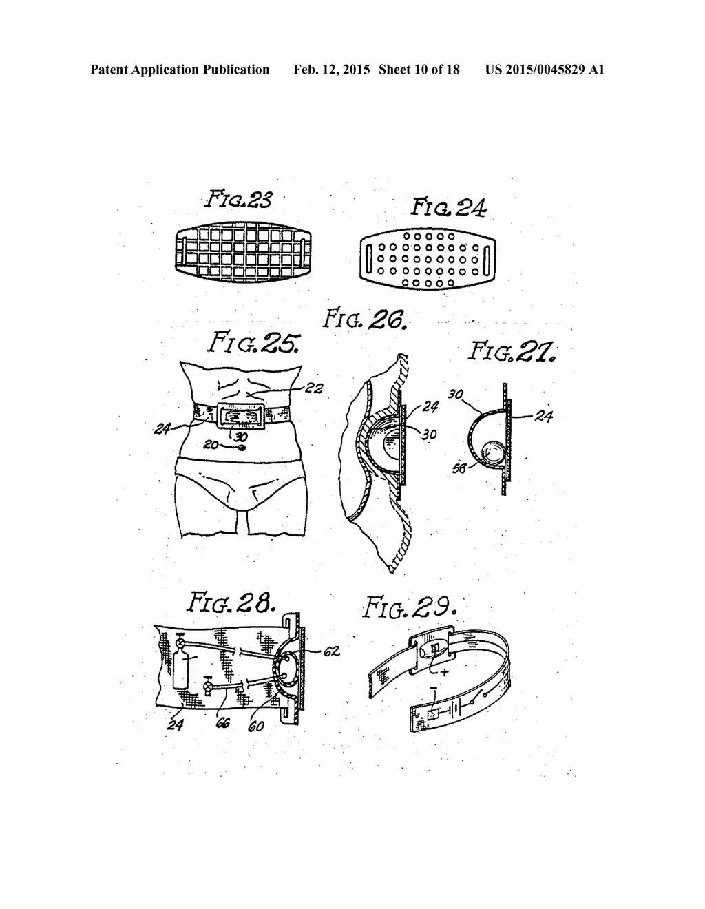 DEVICE AND METHOD FOR APPETITE SUPPRESSION AND WEIGHT LOSS MANAGEMENT - diagram, schematic, and image 11