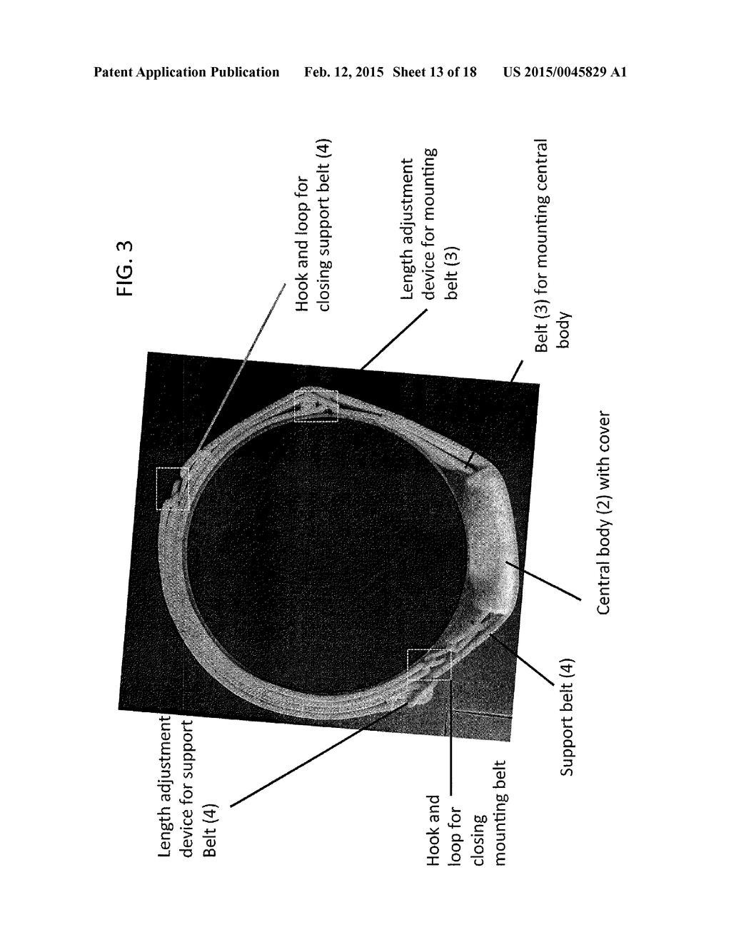 DEVICE AND METHOD FOR APPETITE SUPPRESSION AND WEIGHT LOSS MANAGEMENT - diagram, schematic, and image 14