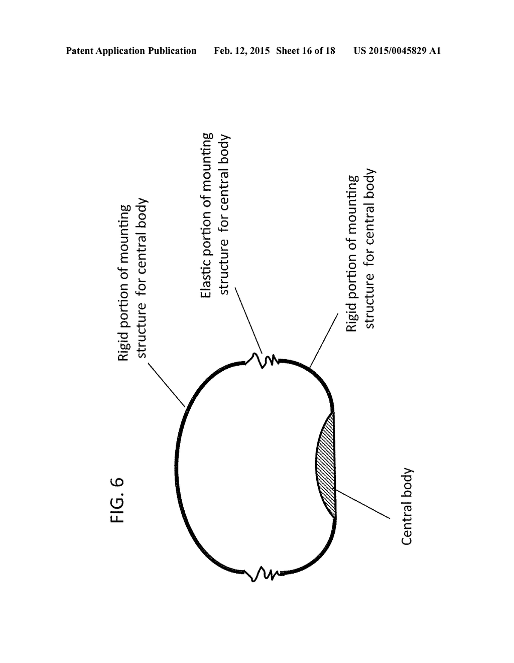 DEVICE AND METHOD FOR APPETITE SUPPRESSION AND WEIGHT LOSS MANAGEMENT - diagram, schematic, and image 17