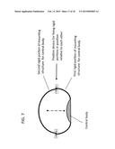 DEVICE AND METHOD FOR APPETITE SUPPRESSION AND WEIGHT LOSS MANAGEMENT diagram and image