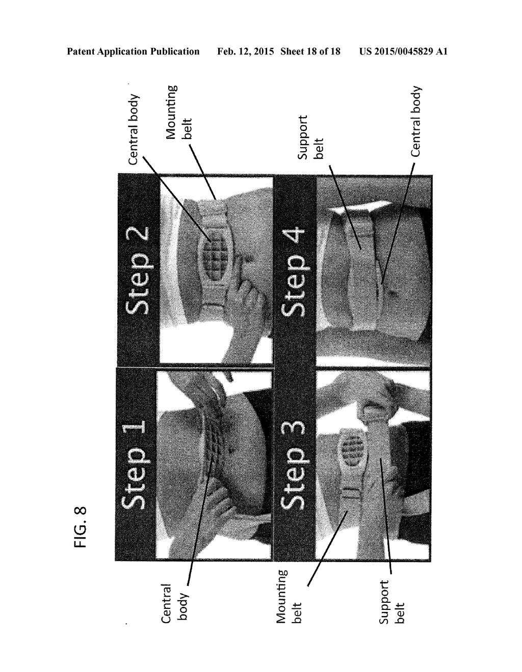 DEVICE AND METHOD FOR APPETITE SUPPRESSION AND WEIGHT LOSS MANAGEMENT - diagram, schematic, and image 19