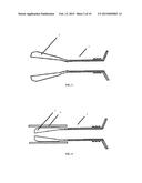 UNIVERSAL ANCHOR FOR BONE FIXATION diagram and image