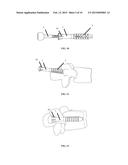 UNIVERSAL ANCHOR FOR BONE FIXATION diagram and image