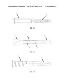 UNIVERSAL ANCHOR FOR BONE FIXATION diagram and image