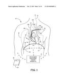 MEDICAL DEVICE TO PROVIDE BREATHING THERAPY diagram and image