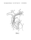 MEDICAL DEVICE TO PROVIDE BREATHING THERAPY diagram and image