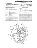 METHOD AND APPARATUS FOR RESHAPING A VENTRICLE diagram and image