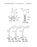 METHOD AND APPARATUS FOR RESHAPING A VENTRICLE diagram and image