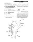 System and Method for Fracture Replacement of Comminuted Bone Fractures or     Portions Thereof Adjacent Bone Joints diagram and image