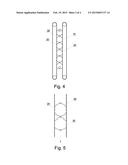 Multi-segment cleaning device diagram and image