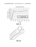 Methods and Systems for Extrusion diagram and image