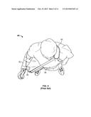 ARM IMMOBILIZATION DEVICE AND ASSOCIATED METHODS diagram and image