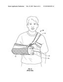 ARM IMMOBILIZATION DEVICE AND ASSOCIATED METHODS diagram and image