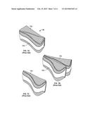 ARM IMMOBILIZATION DEVICE AND ASSOCIATED METHODS diagram and image