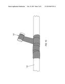 METHOD OF MANUFACTURING A RIGID REPAIR WRAP INCLUDING A LAMINATE DISPOSED     LATERALLY WITHIN THE REPAIR WRAP diagram and image