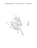 SURGICAL INSTRUMENT WITH CLIPS HAVING TRANSECTING BLADES diagram and image