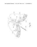 SURGICAL INSTRUMENT WITH CLIPS HAVING TRANSECTING BLADES diagram and image