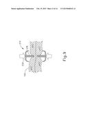 SURGICAL INSTRUMENT WITH CLIPS HAVING TRANSECTING BLADES diagram and image