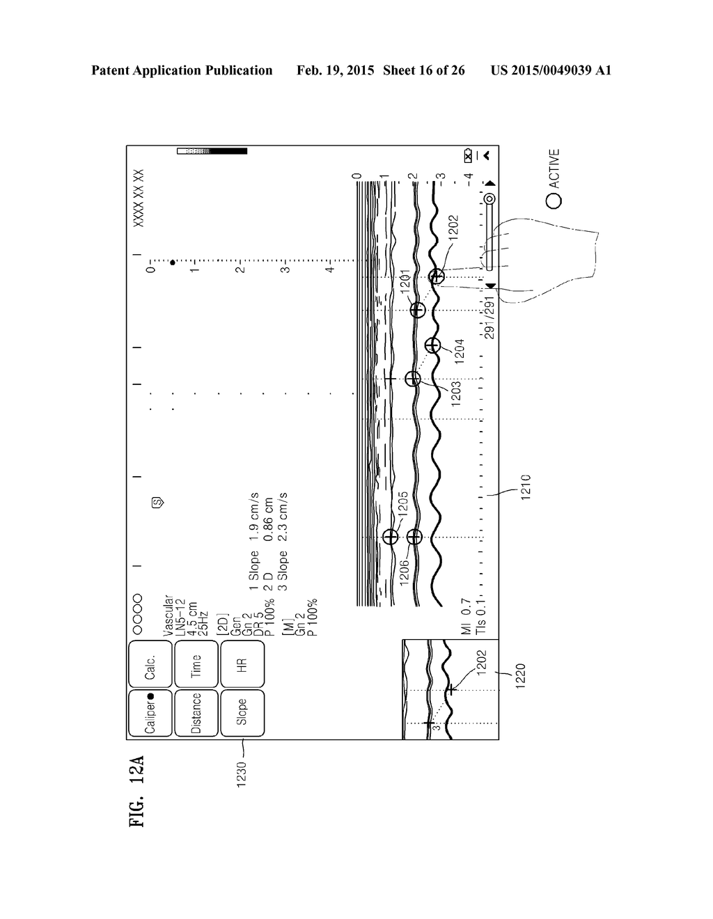 METHOD OF PROVIDING COPY IMAGE AND ULTRASOUND APPARATUS THEREFOR - diagram, schematic, and image 17