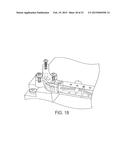 HINGE MECHANISM FOR A FLUID FILLED LENS ASSEMBLY diagram and image