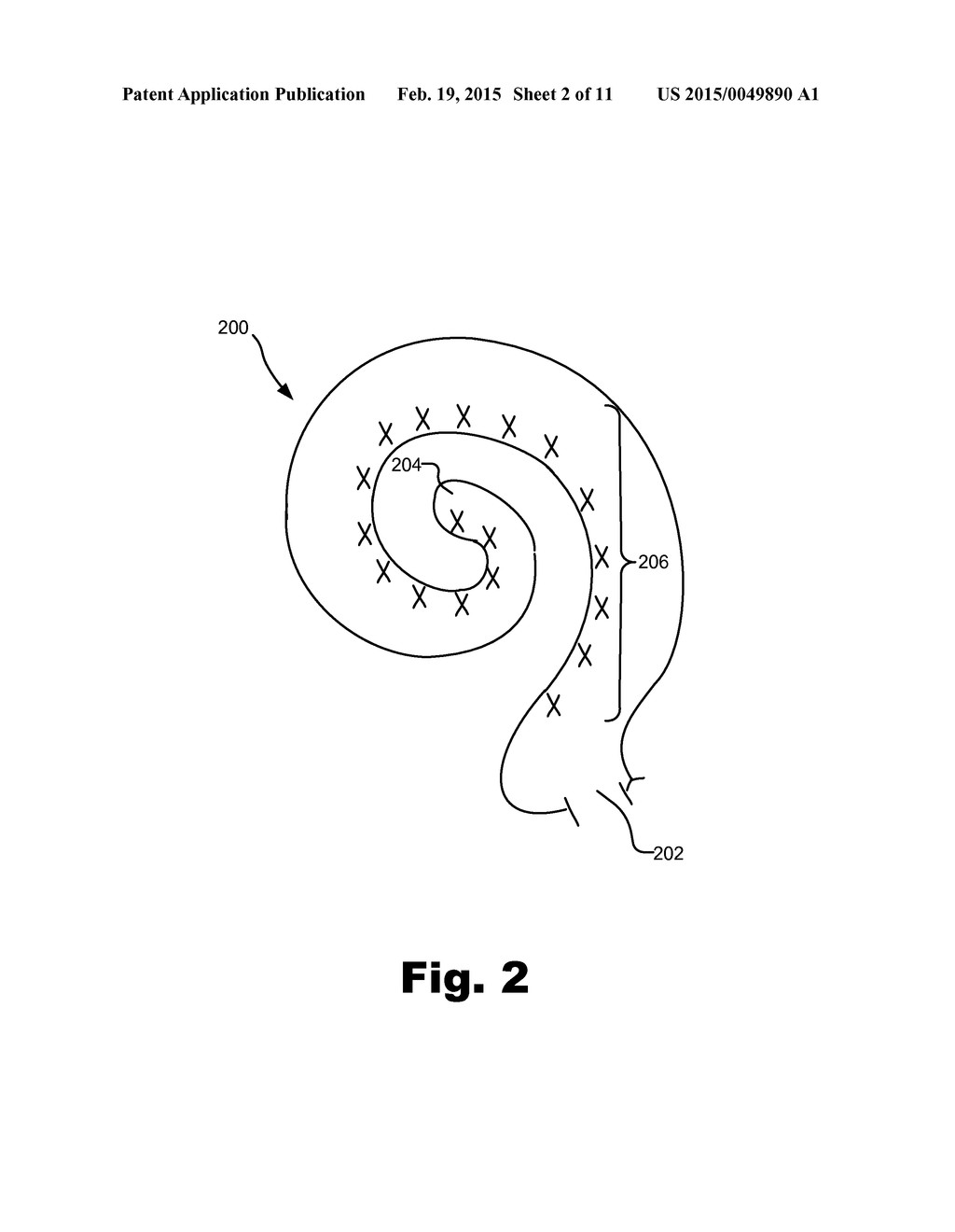 METHODS AND SYSTEMS FOR FITTING AN ELECTRO-ACOUSTIC STIMULATION SYSTEM TO     A PATIENT - diagram, schematic, and image 03