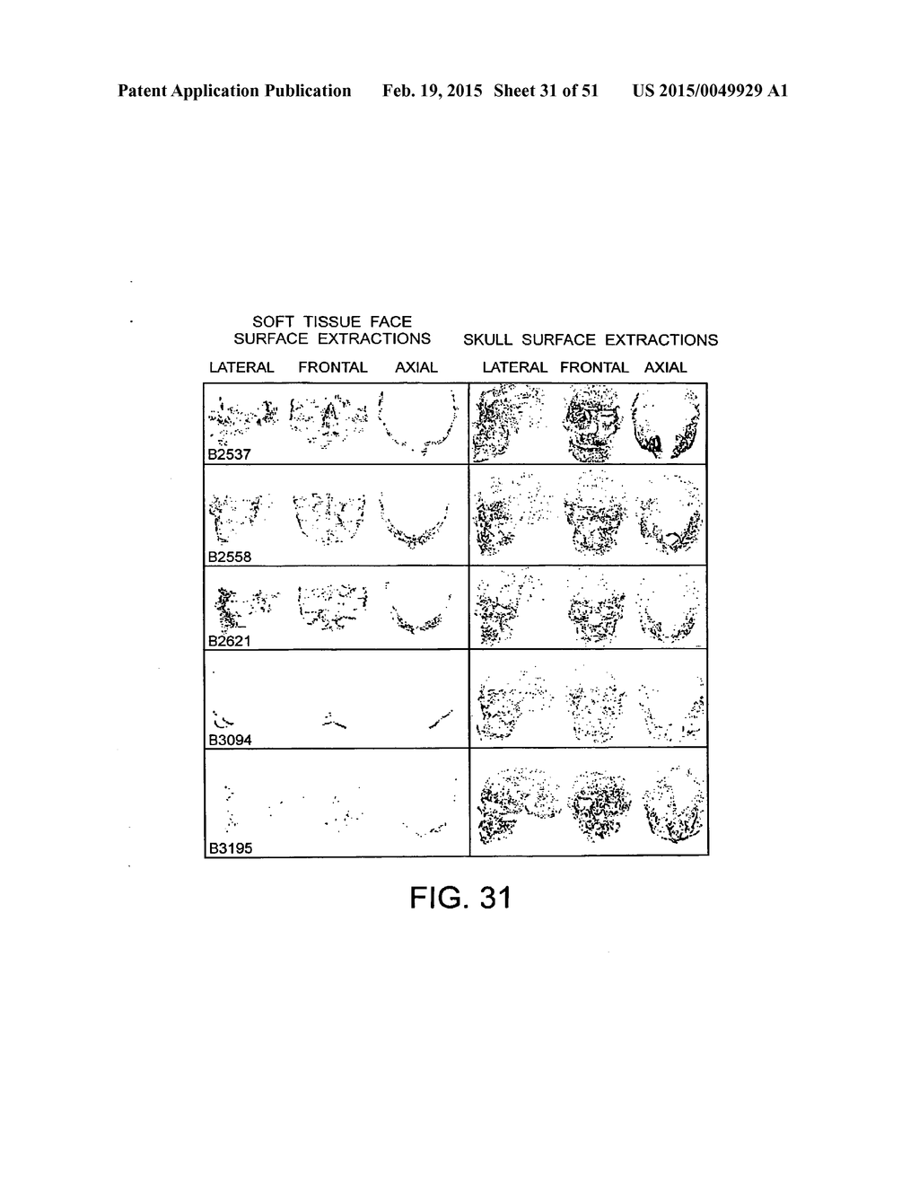 METHODS AND SYSTEMS FOR PRODUCING AN IMPLANT - diagram, schematic, and image 32