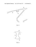 ANNULUS FILLER diagram and image