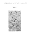 PROTEIN-BASED THERAPY AND DIAGNOSIS OF TAU-MEDIATED PATHOLOGY IN     ALZHEIMER S DISEASE diagram and image