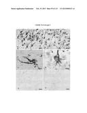 PROTEIN-BASED THERAPY AND DIAGNOSIS OF TAU-MEDIATED PATHOLOGY IN     ALZHEIMER S DISEASE diagram and image