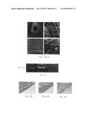 Natural Tissue-Derived Decellularized Matrix and Methods of Generating and     Using Same diagram and image