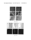 Natural Tissue-Derived Decellularized Matrix and Methods of Generating and     Using Same diagram and image