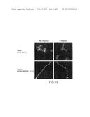 ANTIBODY BINDING MICROBIAL HEPARIN BINDING MOTIF TO RETARD OR PREVENT     MICROBIAL BIOFILM FORMATION ON IMPLANTED MEDICAL DEVICES diagram and image