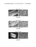 ANTIBODY BINDING MICROBIAL HEPARIN BINDING MOTIF TO RETARD OR PREVENT     MICROBIAL BIOFILM FORMATION ON IMPLANTED MEDICAL DEVICES diagram and image