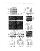 COMPOSITIONS AND METHODS FOR UPREGULATING HIPPOCAMPAL PLASTICITY AND     HIPPOCAMPUS-DEPENDENT LEARNING AND MEMORY diagram and image