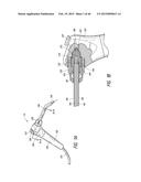 DENTAL SYRINGE TIP DEVICES, SYSTEMS AND METHODS diagram and image