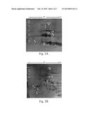 METHOD OF TREATING LEUKEMIA USING RICE PROLAMIN diagram and image