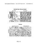 METHODS AND COMPOSITIONS FOR TREATMENT OF FIBROSIS diagram and image