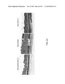 METHODS AND COMPOSITIONS FOR TREATMENT OF FIBROSIS diagram and image