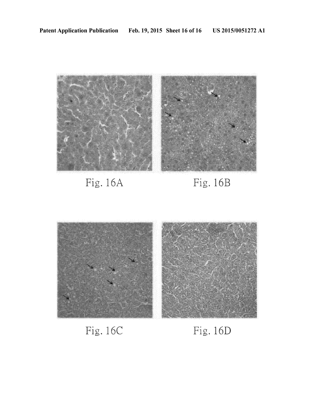 Uses of hydroxyl polymethoxylflavones (HPMFs) and derivatives thereof - diagram, schematic, and image 17