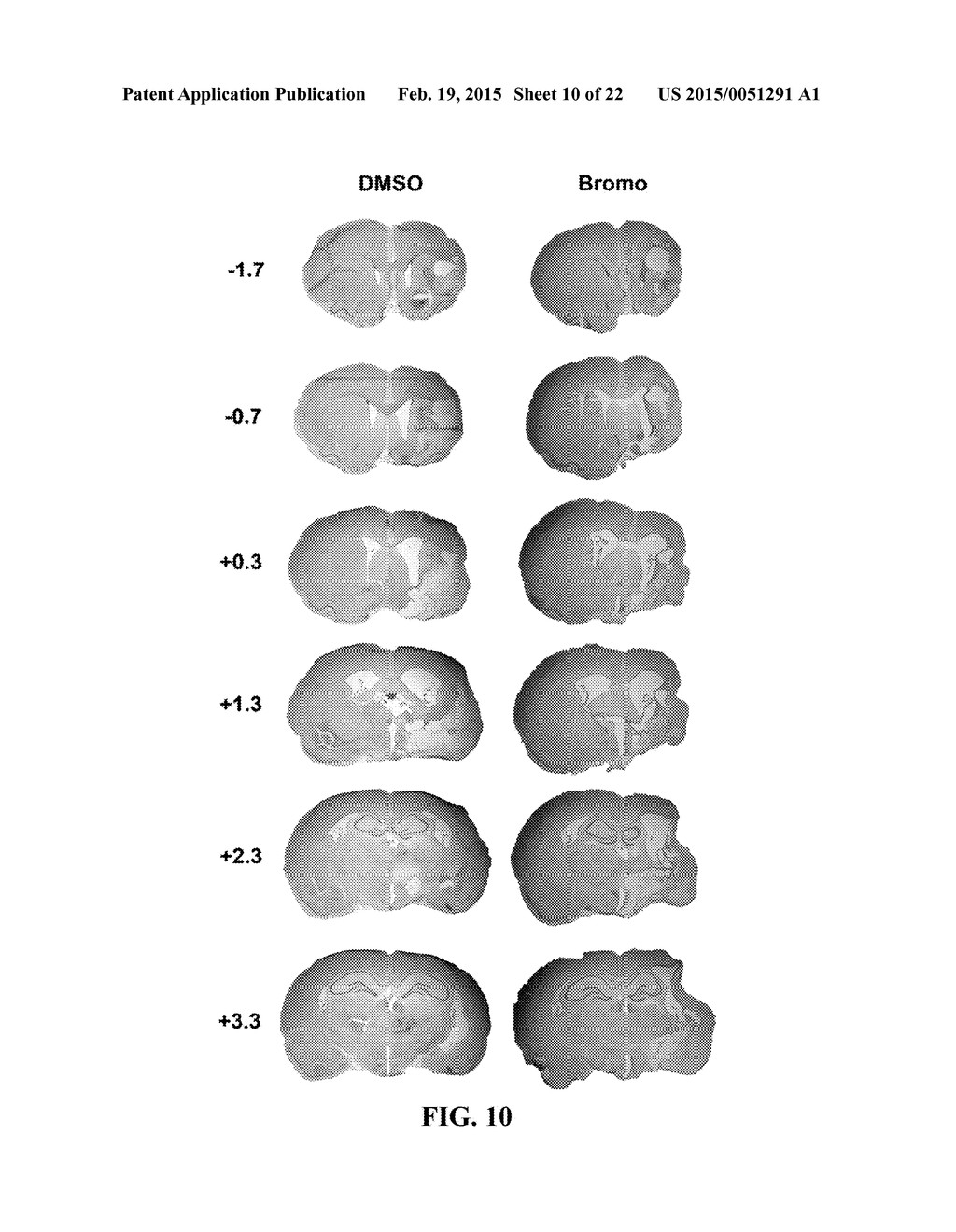 N,N'-DI-1 NAPHTHYLGUANIDINE HCL (NAGH) AND N,N'-DI-P-NITROPHENYLGUANIDINE     HCL (NAD) TREATMENT FOR STROKE AT DELAYED TIMEPOINTS - diagram, schematic, and image 11